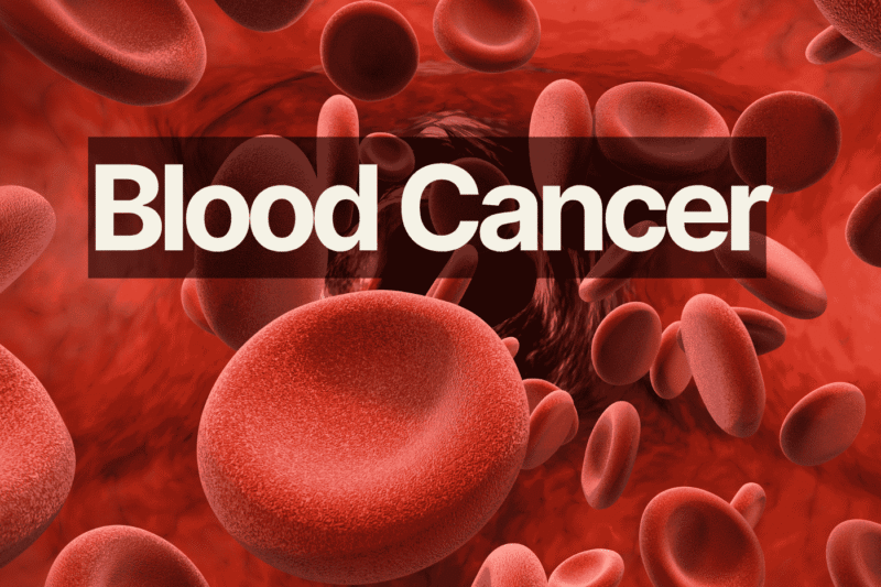 Signs of Cancer of the Blood: What You Should Know About the Hidden Symptoms