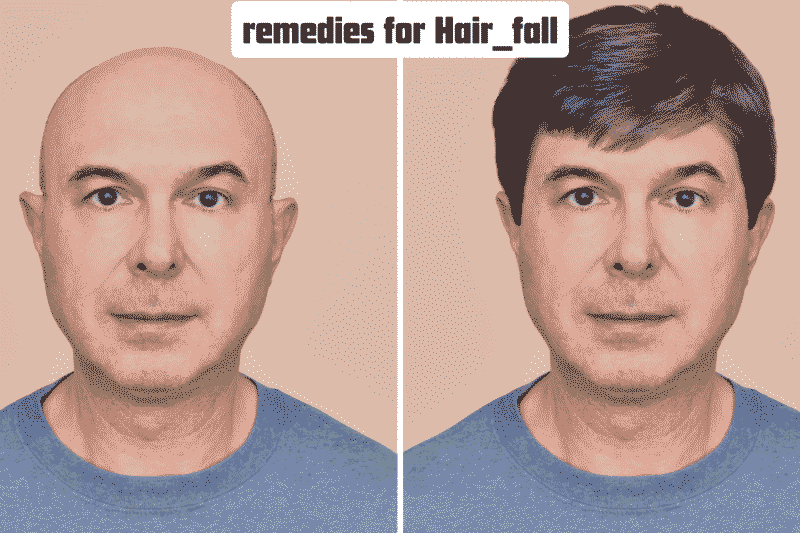 Proven Hair Loss Remedies That Actually Work